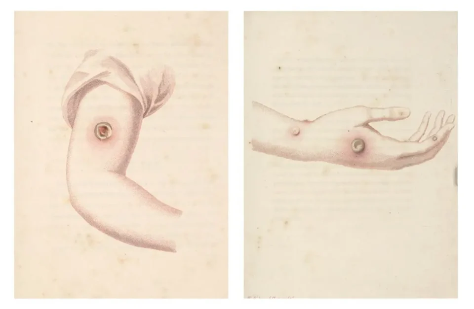 Vaccination book illustration